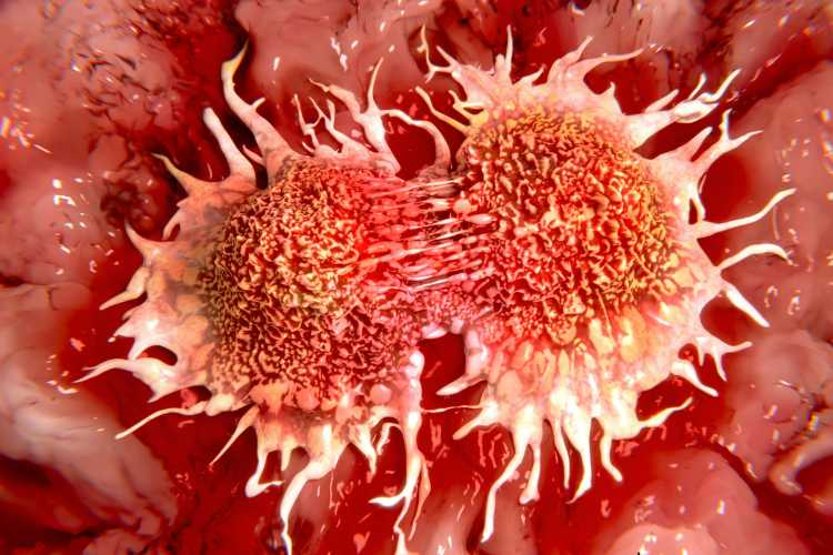 Cancro - fonte_Canva - inchiostroverde.it
